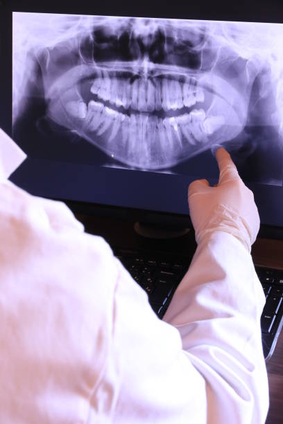 Best Emergency Wisdom Tooth Extraction in Muscoda, WI